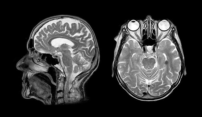 dicom-basics-header